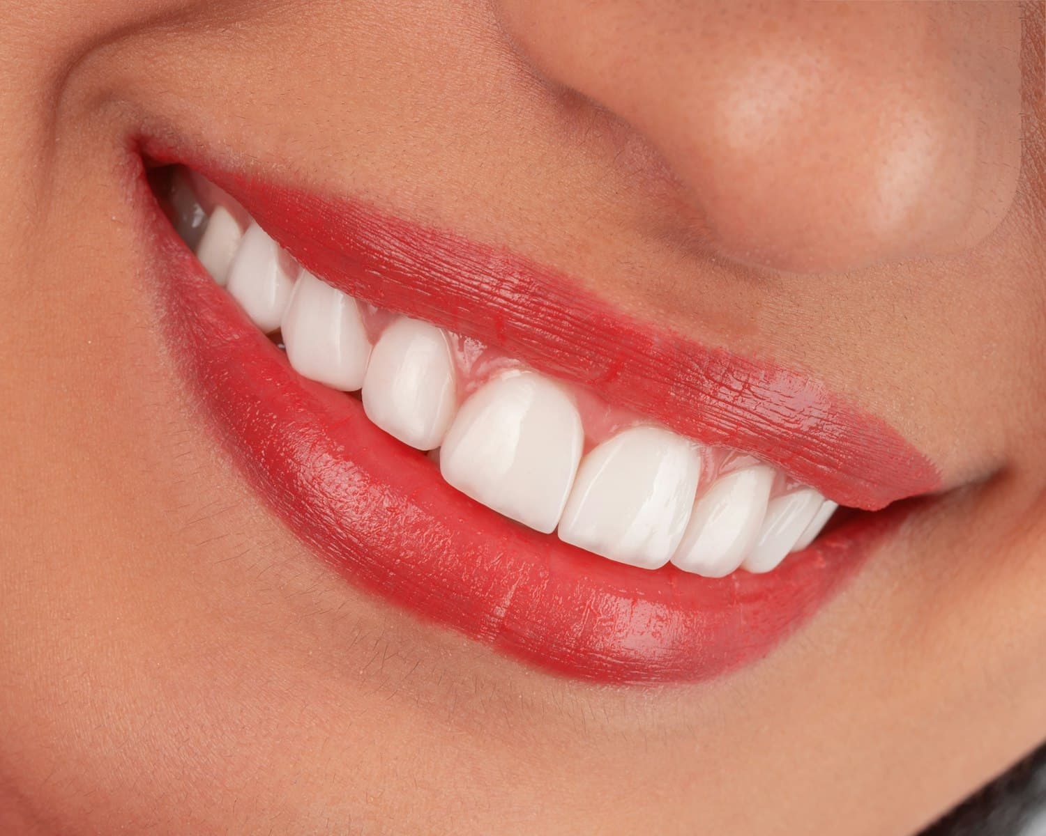 Young patient smiling with Invisalign First clear aligners